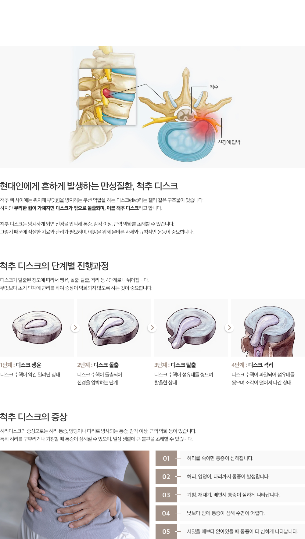 척추 디스크 설명
