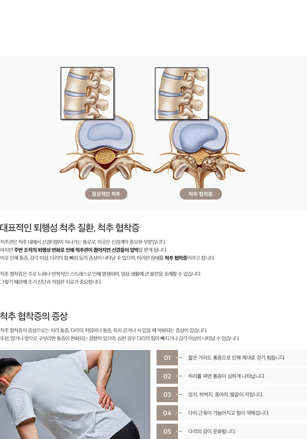 척추 협착증 설명