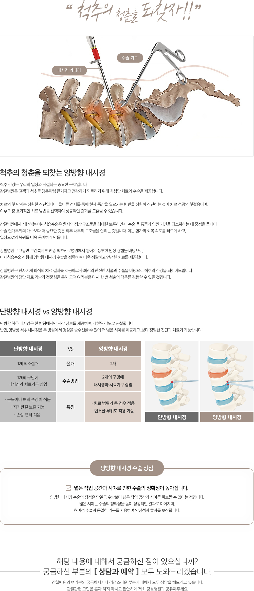 양방향 내시경